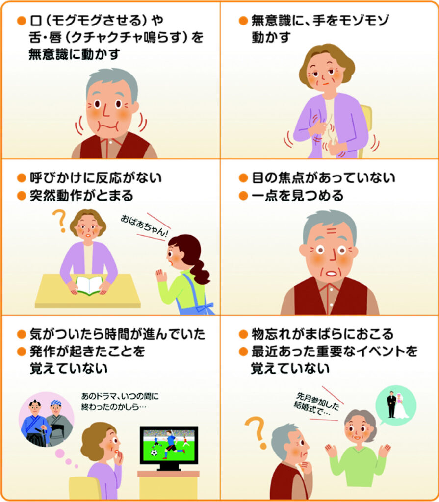 高齢 者 てんかん